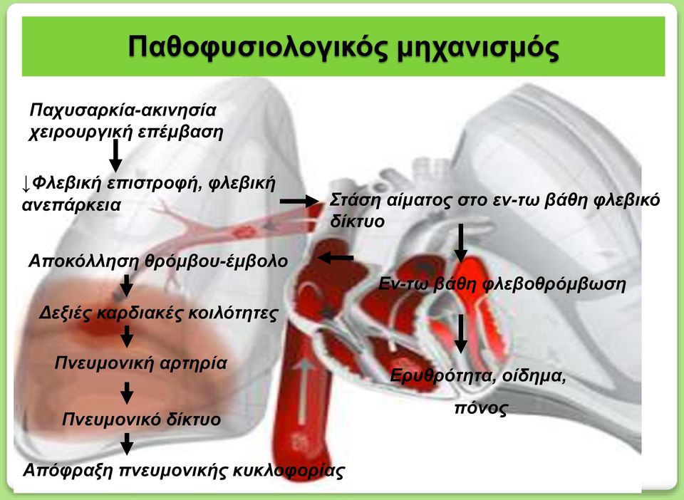 κοιλότητες Στάση αίματος στο εν-τω βάθη φλεβικό δίκτυο Εν-τω βάθη φλεβοθρόμβωση