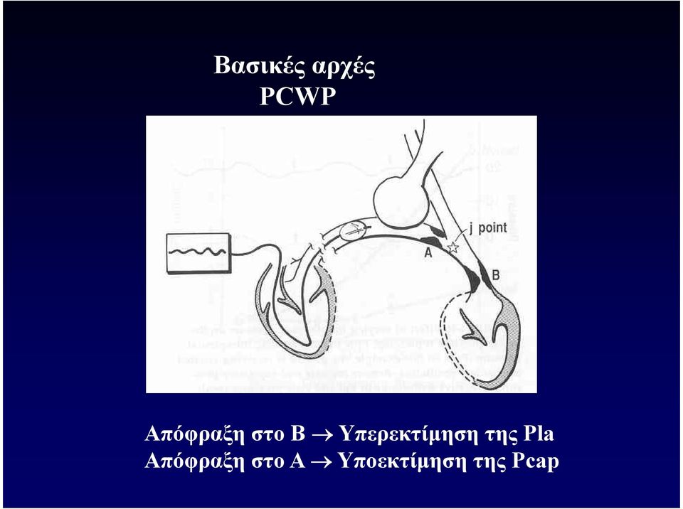 Υπερεκτίµηση της Pla