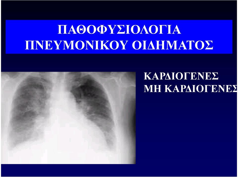 ΗΜΑΤΟΣ ΚΑΡ