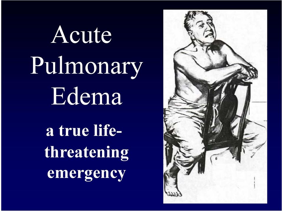 Edema a true