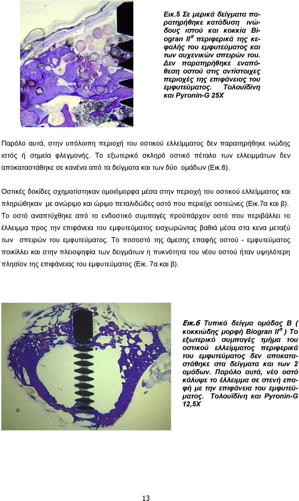 Τολουϊδίνη και Pyronin-G 25X Παρόλο αυτά, στην υπόλοιπη περιοχή του οστικού ελλείμματος δεν παρατηρήθηκε ινώδης ιστός ή σημεία φλεγμονής.