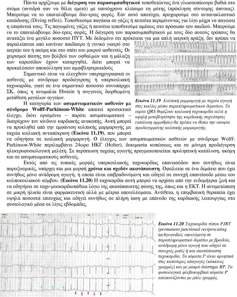 Τοποθετούµε παγάκια σε γάζες ή πετσέτα περιµένοντας για λίγο µέχρι να παγώσει η επιφάνειά τους. Τις παγωµένες γάζες ή πετσέτα τοποθετούµε αµέσως στο πρόσωπο του παιδιού.