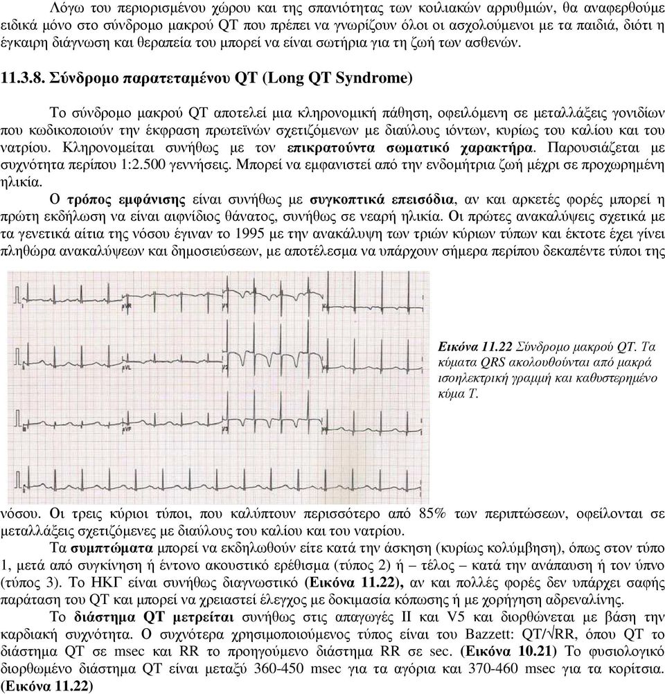 Σύνδροµο παρατεταµένου QT (Long QT Syndrome) Το σύνδροµο µακρού QT αποτελεί µια κληρονοµική πάθηση, οφειλόµενη σε µεταλλάξεις γονιδίων που κωδικοποιούν την έκφραση πρωτεϊνών σχετιζόµενων µε διαύλους