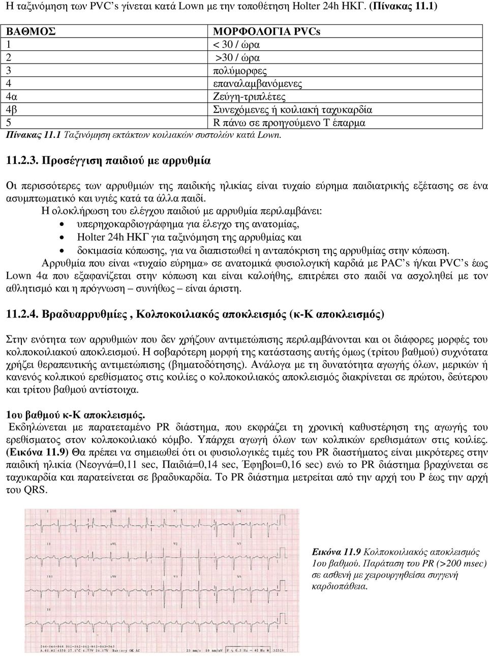 1 Ταξινόµηση εκτάκτων κοιλιακών συστολών κατά Lown. 11.2.3.