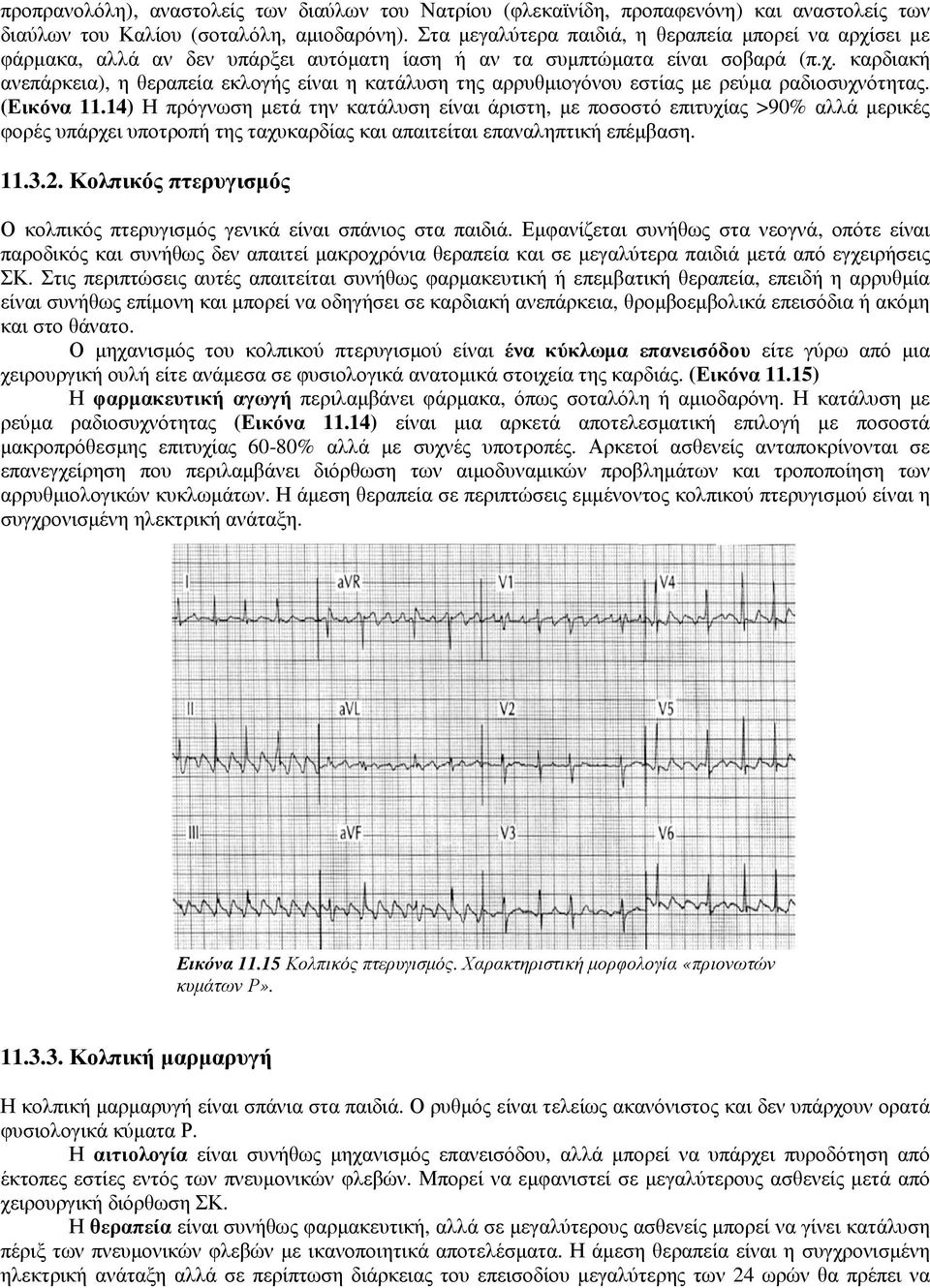 (Εικόνα 11.14) Η πρόγνωση µετά την κατάλυση είναι άριστη, µε ποσοστό επιτυχίας >90% αλλά µερικές φορές υπάρχει υποτροπή της ταχυκαρδίας και απαιτείται επαναληπτική επέµβαση. 11.3.2.