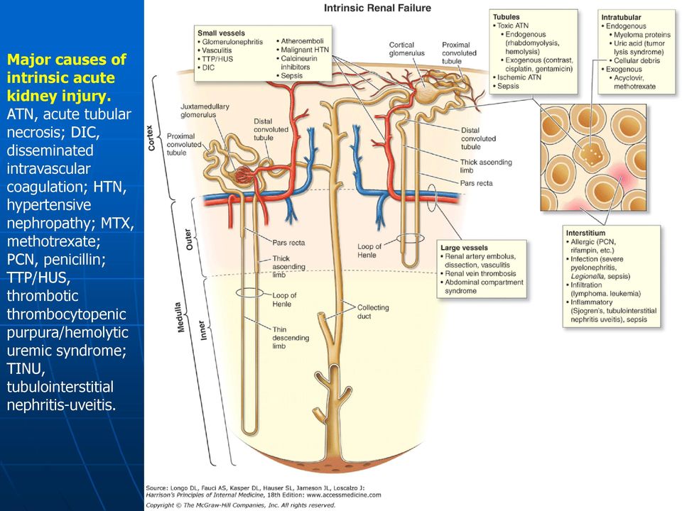 HTN, hypertensive nephropathy; MTX, methotrexate; PCN, penicillin; TTP/HUS,