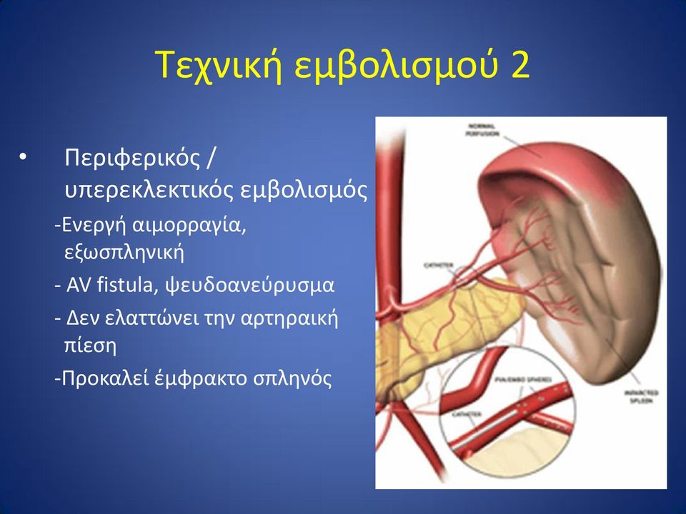 εξωσπληνική - AV fistula, ψευδοανεύρυσμα -