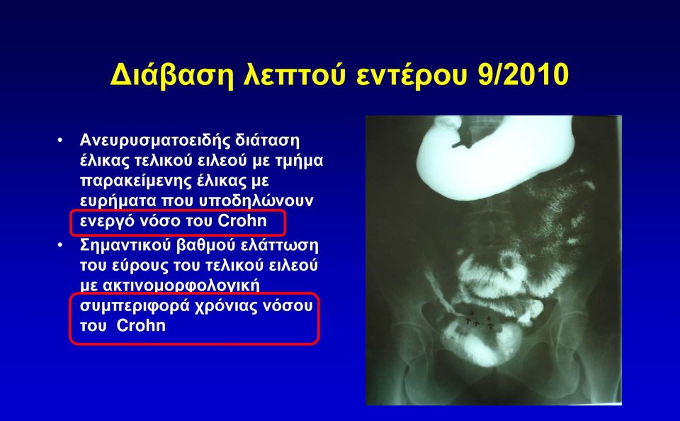 υποδηλώνουν ενεργό νόσο του Crohn Σημαντικού βαθμού ελάττωση του