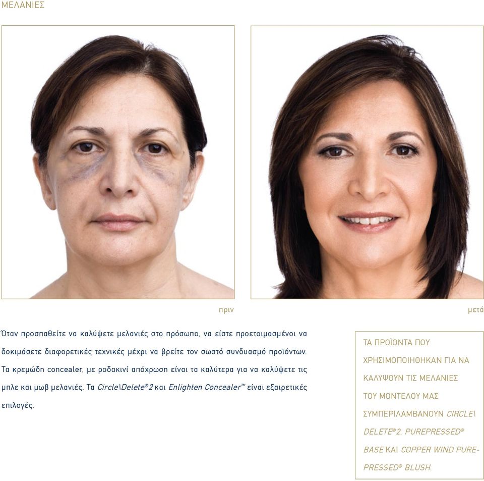 Τα κρεμώδη concealer, με ροδακινί απόχρωση είναι τα καλύτερα για να καλύψετε τις μπλε και μωβ μελανιές.