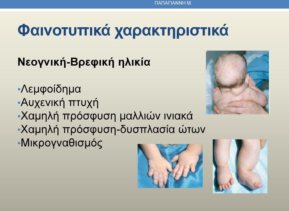Νεογνική-Βρεφική ηλικία Λεμφοίδημα