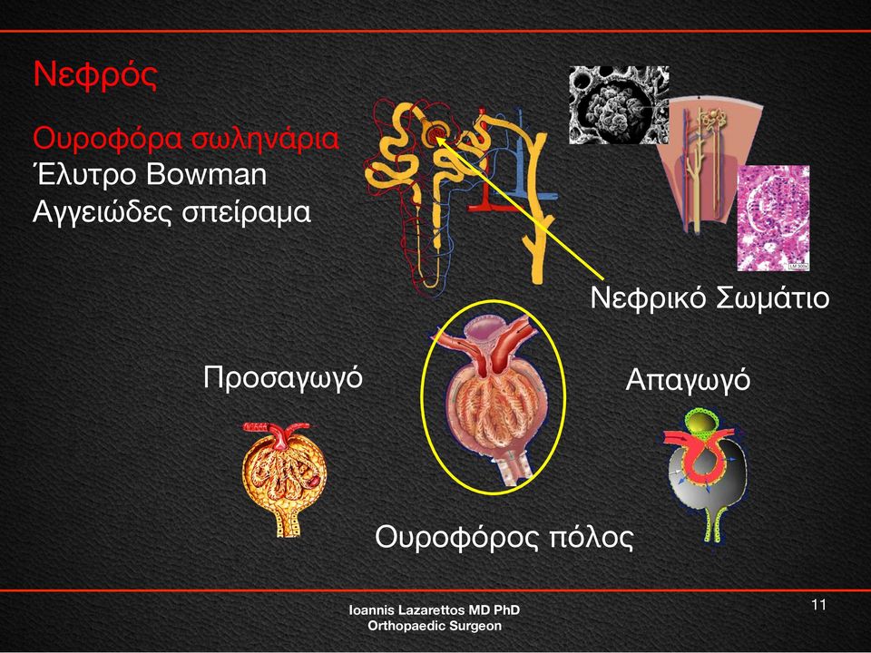 σπείραμα Νεφρικό Σωμάτιο