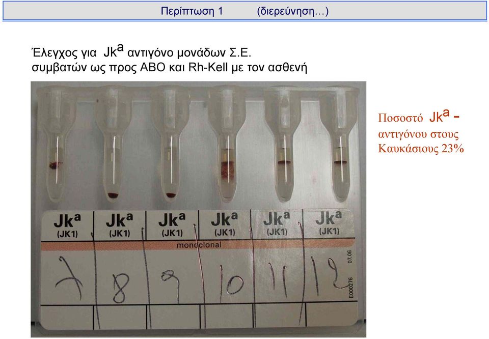 συμβατών ως προς ABO και Rh-Kell με τον