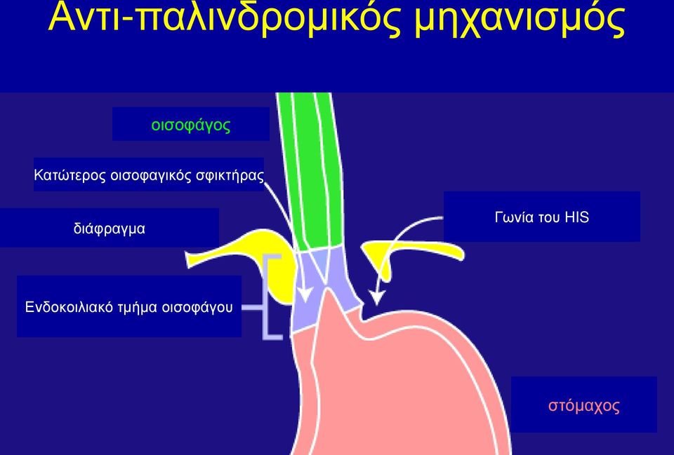 σφικτήρας διάφραγμα Γωνία του HIS