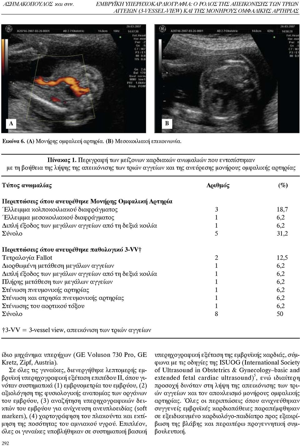 Περιγραφή των μείζονων καρδιακών ανωμαλιών που εντοπίστηκαν με τη βοήθεια της λήψης της απεικόνισης των τριών αγγείων και της ανεύρεσης μονήρους ομφαλικής αρτηρίας Τύπος ανωμαλίας ριθμός (%)