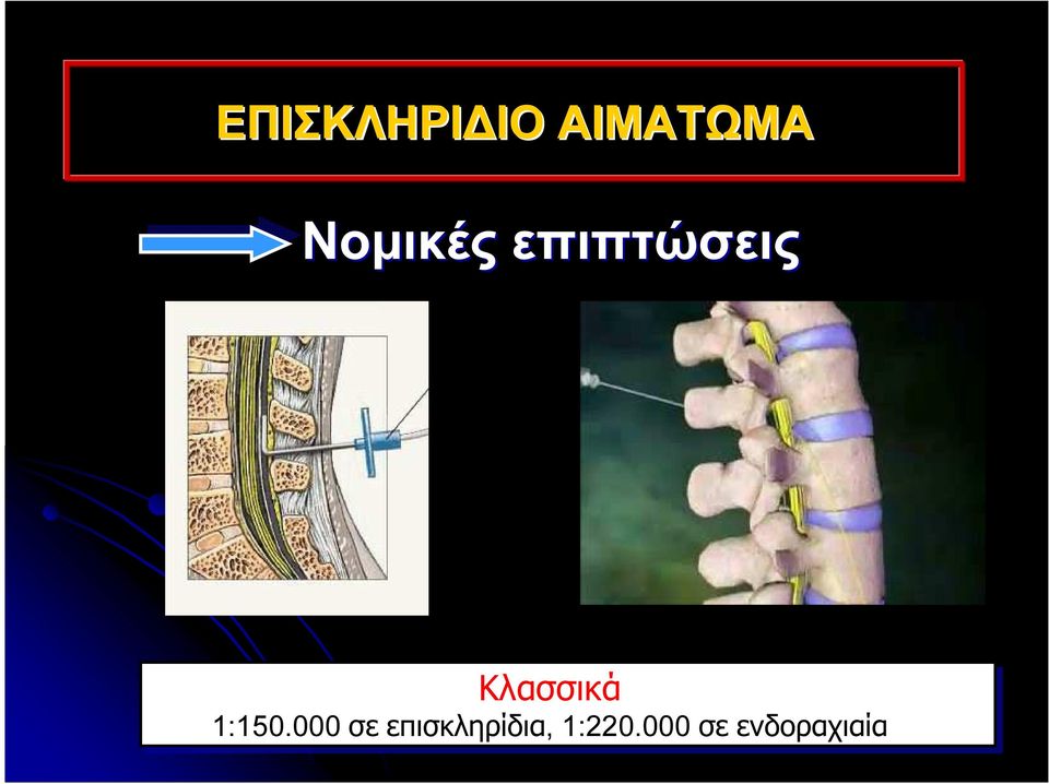 Κλασσικά 1:150.