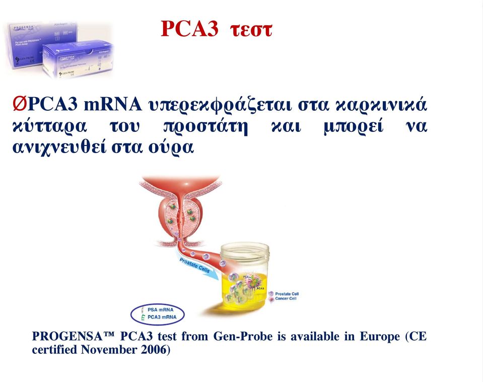ανιχνευθεί στα ούρα PROGENSA PCA3 test from