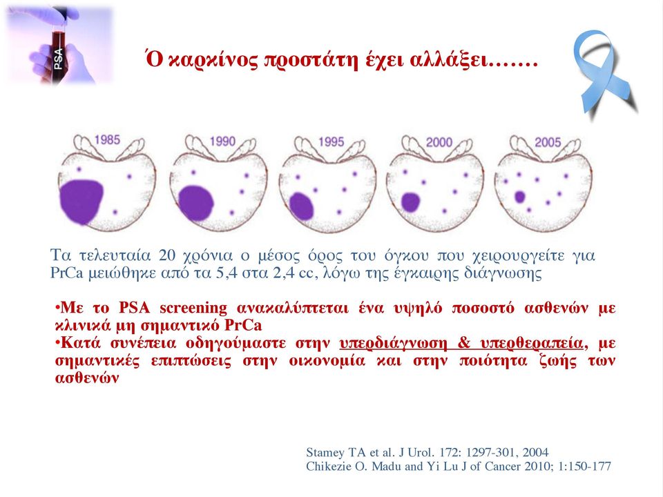 διάγνωσης Με το PSA screening ανακαλύπτεται ένα υψηλό ποσοστό ασθενών με κλινικά μη σημαντικό PrCa Κατά συνέπεια