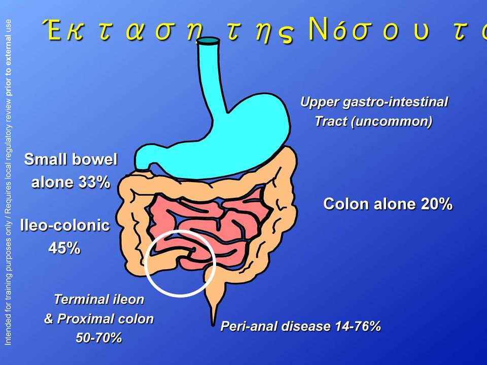 50-70% Upper gastro-intestinal Tract