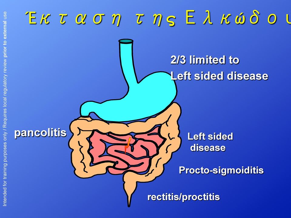disease Left sided disease