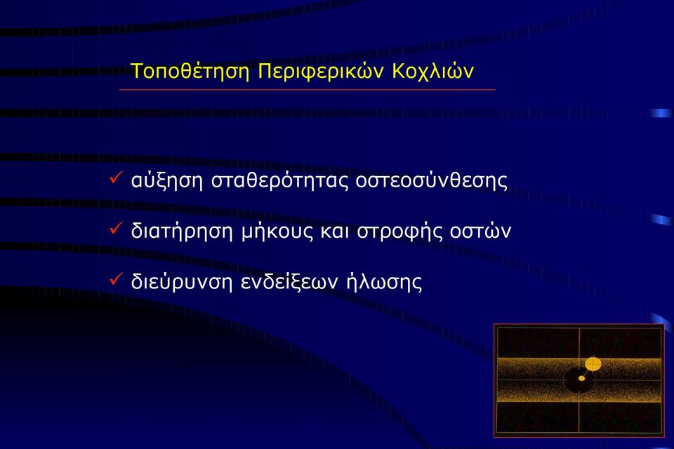 οστεοσύνθεσης διατήρηση μήκους