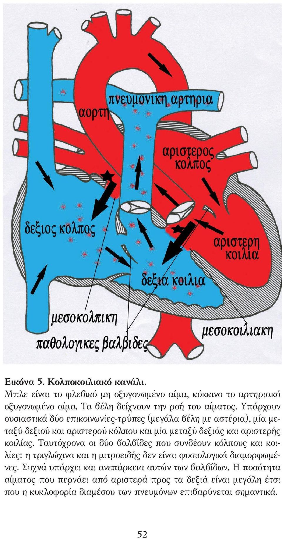 Ταυτόχρονα οι δύο βαλβίδες που συνδέουν κόλπους και κοιλίες: η τριγλώχινα και η µιτροειδής δεν είναι φυσιολογικά διαµορφωµένες.