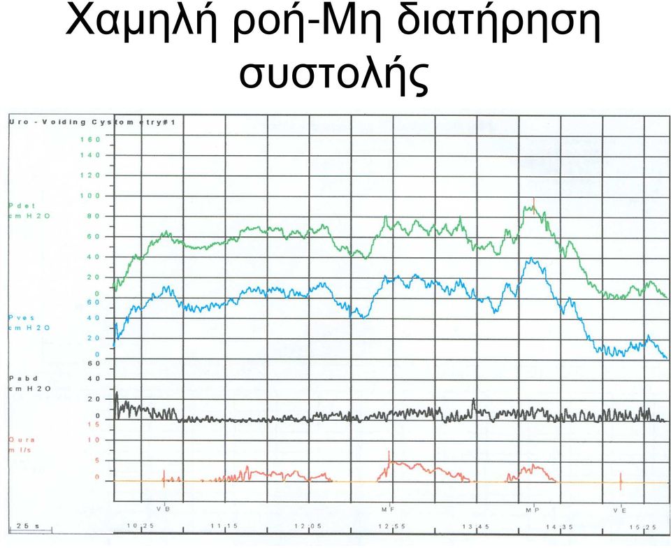 διατήρηση