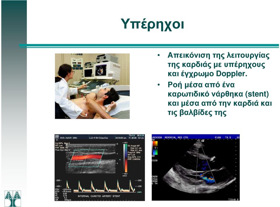 Ροή µέσα από ένα καρωτιδικό νάρθηκα