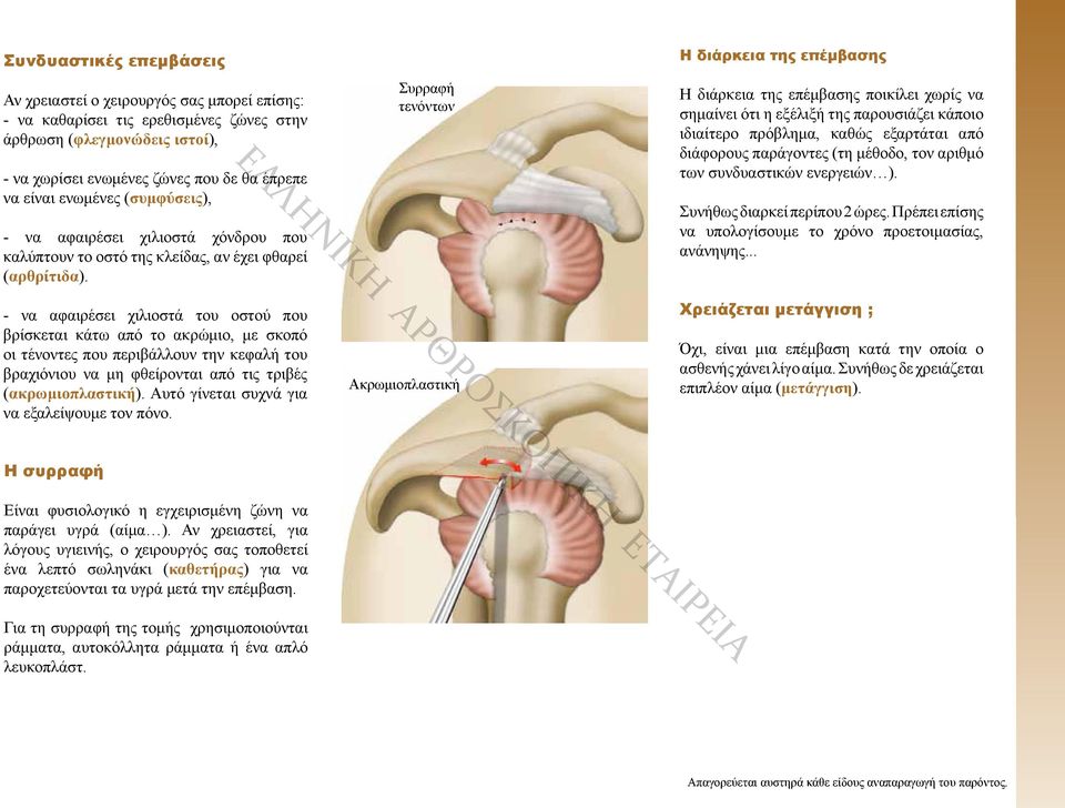 Συρραφή τενόντων Η διάρκεια της επέμβασης Η διάρκεια της επέμβασης ποικίλει χωρίς να σημαίνει ότι η εξέλιξή της παρουσιάζει κάποιο ιδιαίτερο πρόβλημα, καθώς εξαρτάται από διάφορους παράγοντες (τη