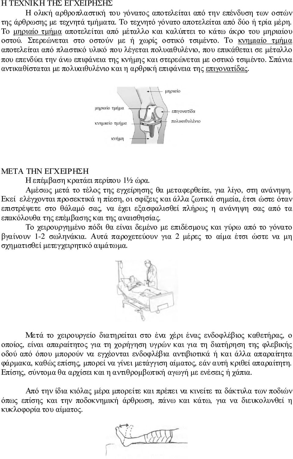 To κνηµιαίο τµήµα αποτελείται από πλαστικό υλικό που λέγεται πολυαιθυλένιο, που επικάθεται σε µέταλλο που επενδύει την άνω επιφάνεια της κνήµης και στερεώνεται µε οστικό τσιµέντο.