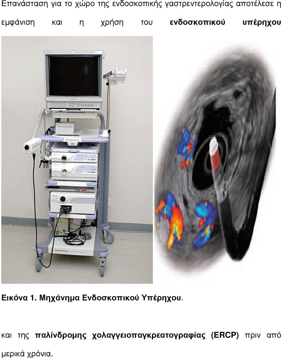 Εικόνα 1. Μηχάνηµα Ενδοσκοπικού Υπέρηχου.