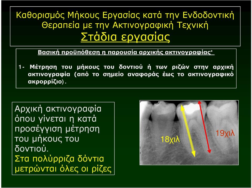 αρχική ακτινογραφία (από το σημείο αναφοράς έως το ακτινογραφικό ακρορρίζιο).