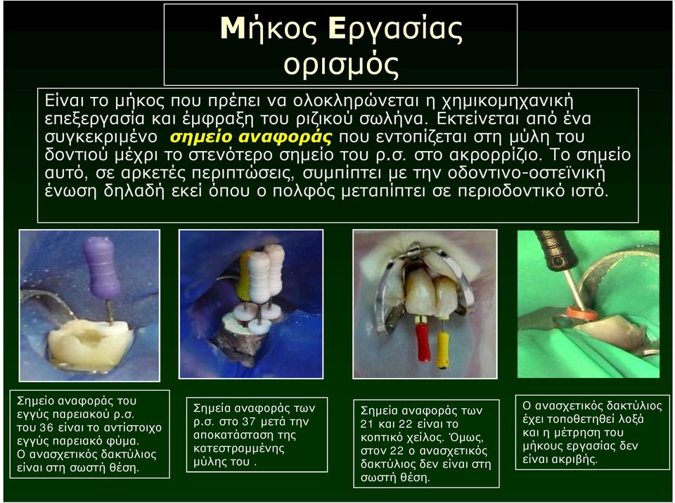 Το σημείο αυτό, σε αρκετές περιπτώσεις, συμπίπτει με την οδοντινο-οστεϊνική ένωση δηλαδή εκεί όπου ο πολφός μεταπίπτει σε περιοδοντικό ιστό. Σημείο αναφοράς του εγγύς παρειακού ρ.σ. του 36 είναι το αντίστοιχο εγγύς παρειακό φύμα.