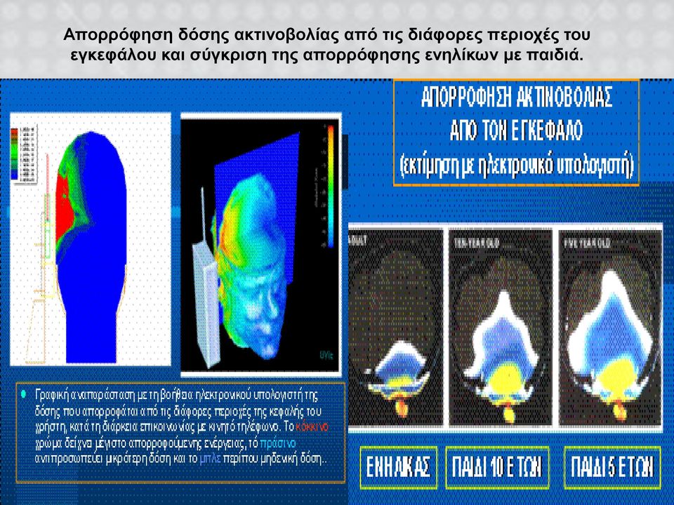 εγκεφάλου και σύγκριση της