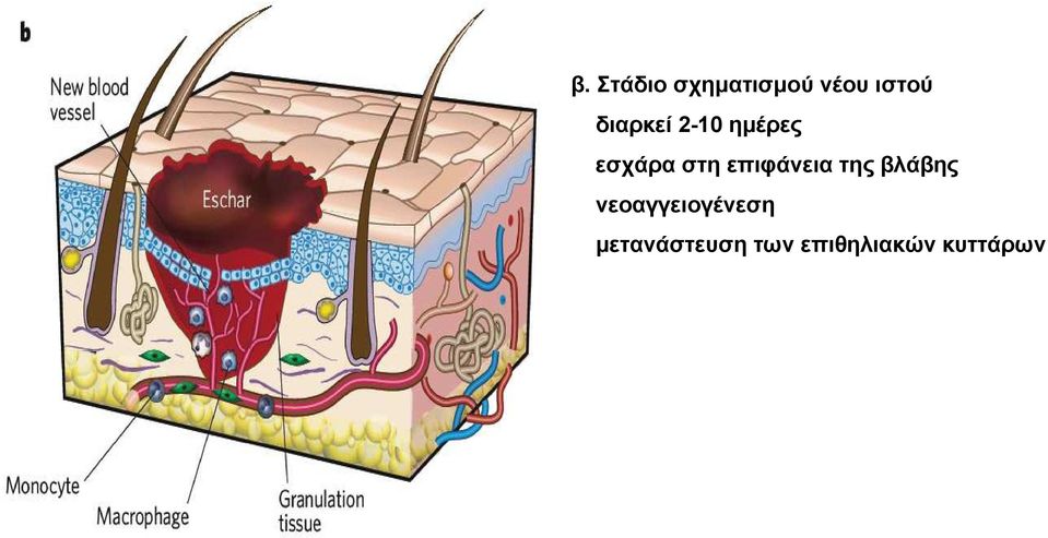 επιφάνεια της βλάβης