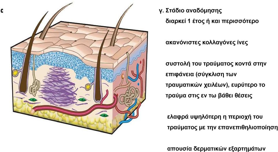 τραυµατικών χειλέων), ευρύτερο το τραύµα στις εν τω βάθει θέσεις ελαφρά