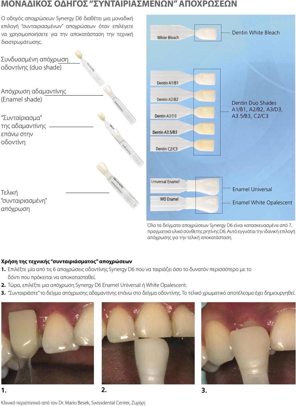 Dentin White Bleach Συνδυασμένη απόχρωση οδοντίνης (duo shade) Απόχρωση αδαμαντίνης (Enamel shade) Συνταίριασμα της αδαμαντίνης επάνω στην οδοντίνη Dentin Duo Shades A1/B1, A2/B2, A3/D3, A3.