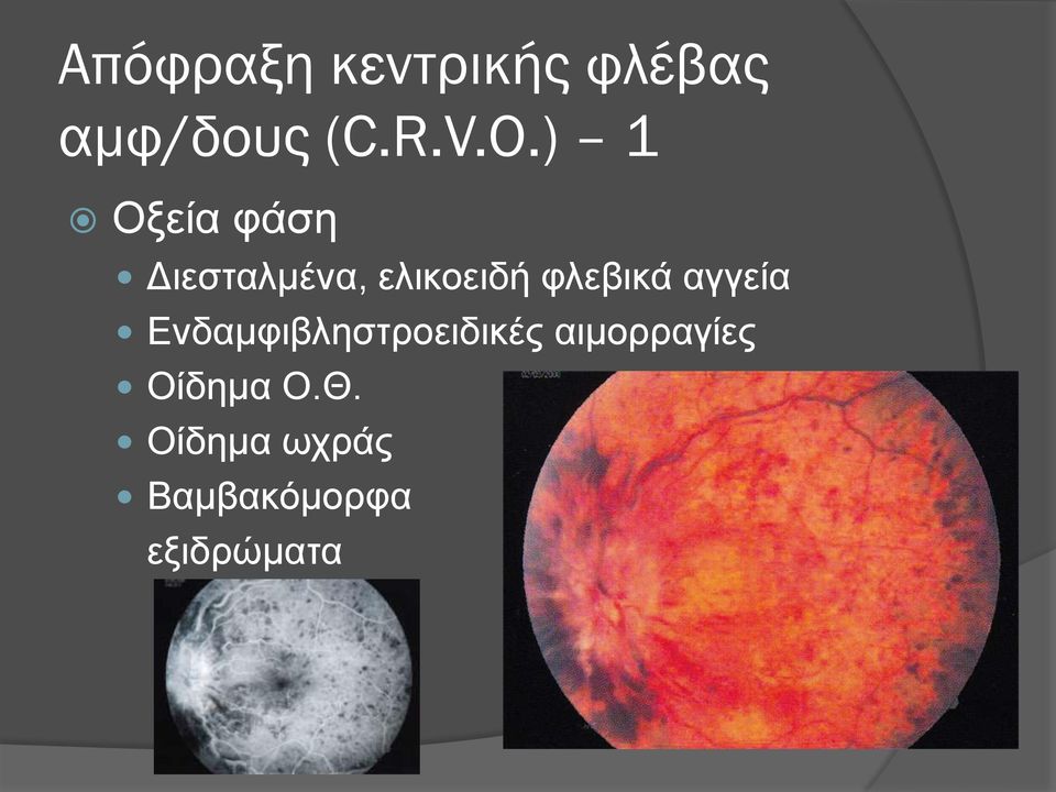 φλεβικά αγγεία Ενδαμφιβληστροειδικές