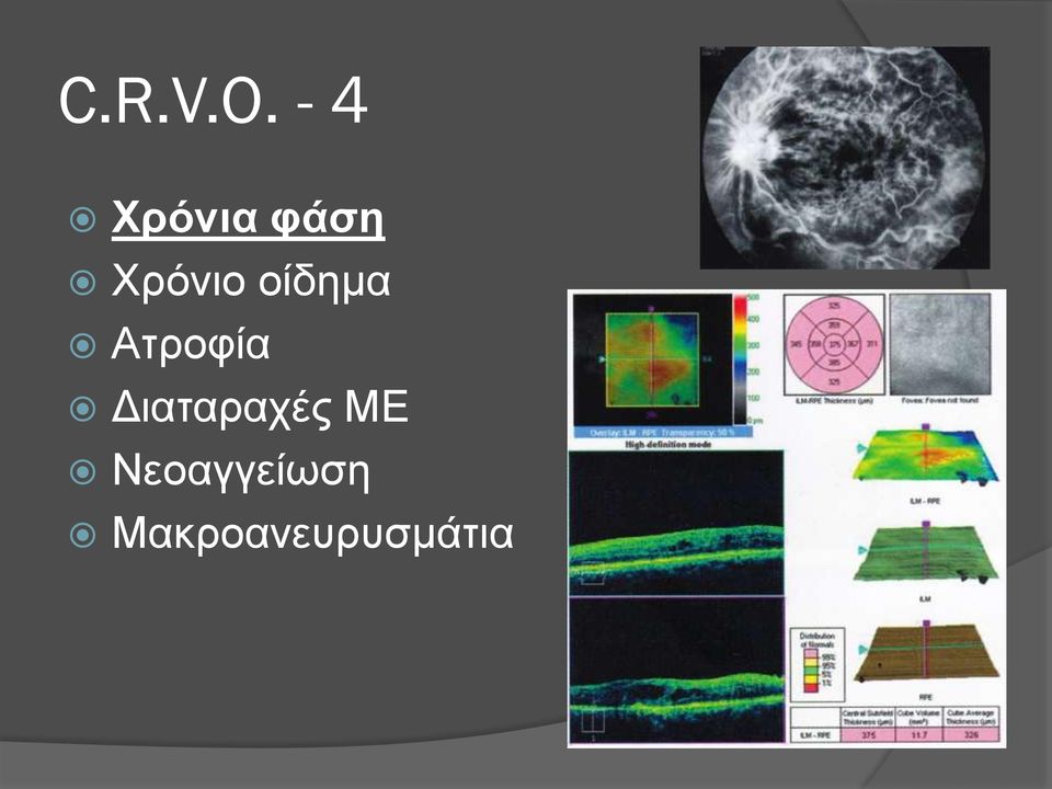 οίδημα Ατροφία