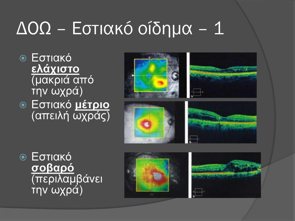 Εστιακό μέτριο (απειλή ωχράς)