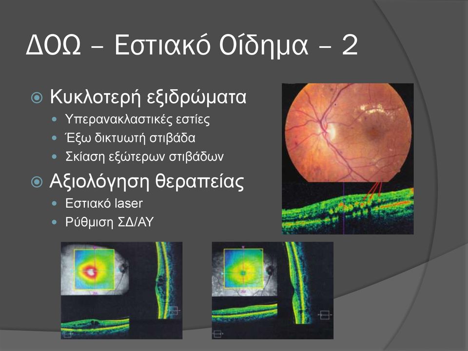 δικτυωτή στιβάδα Σκίαση εξώτερων