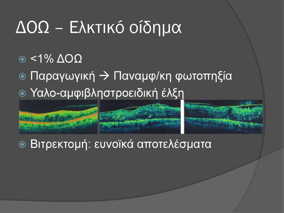 φωτοπηξία