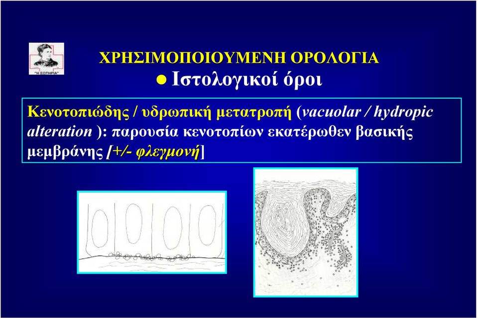 ): παρουσία κενοτοπίων εκατέρωθεν