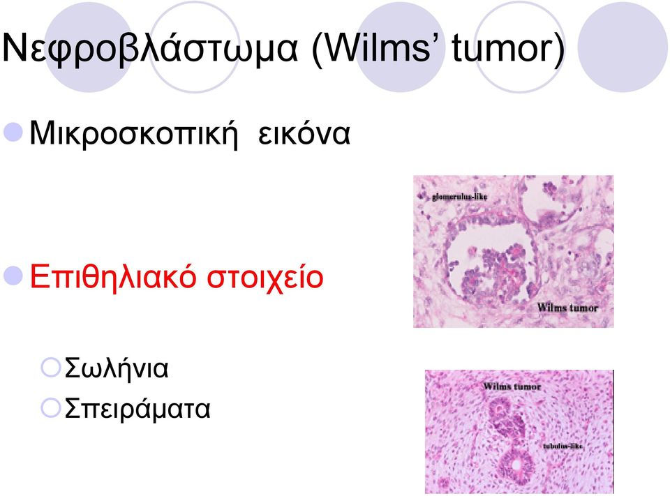 εικόνα Επιθηλιακό