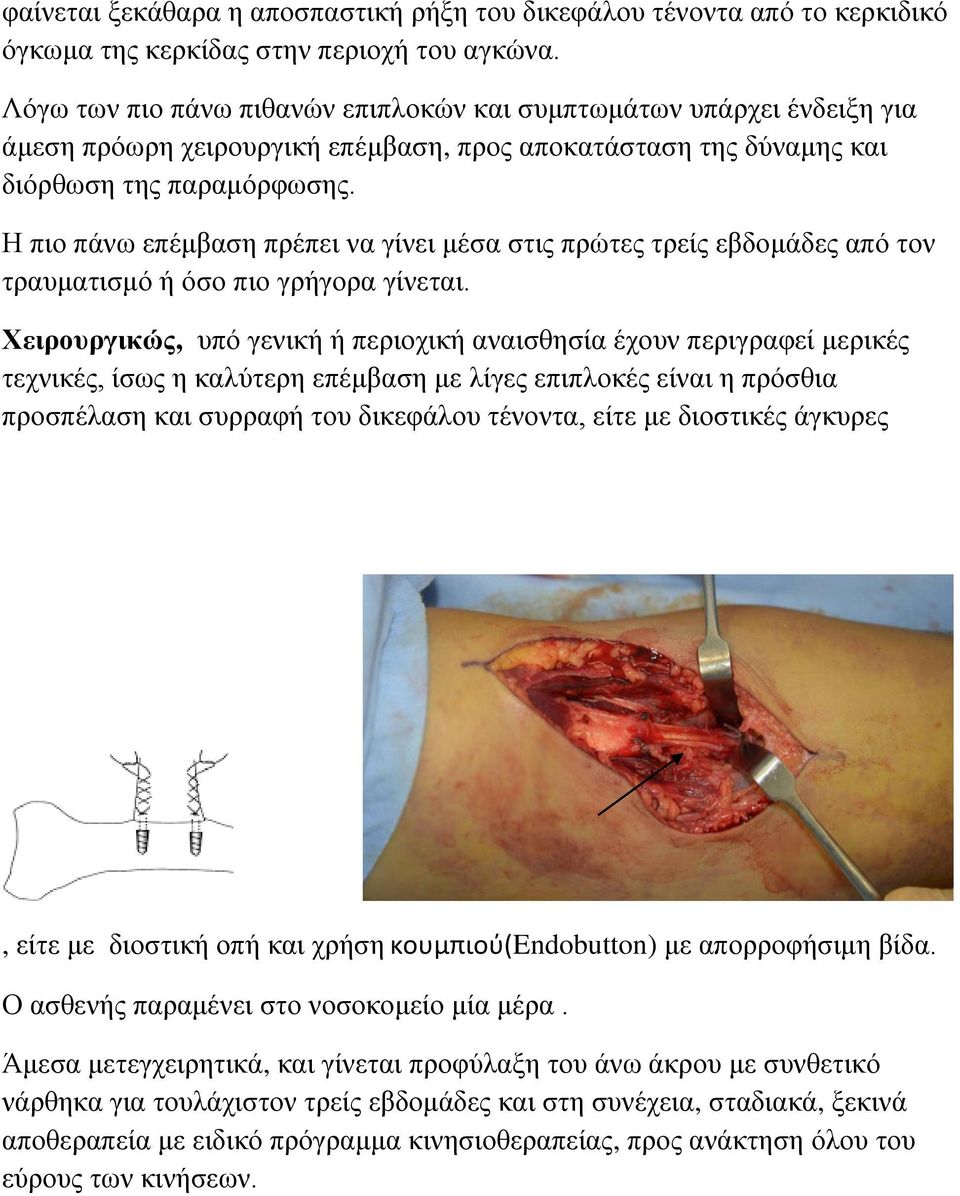 Η πιο πάνω επέμβαση πρέπει να γίνει μέσα στις πρώτες τρείς εβδομάδες από τον τραυματισμό ή όσο πιο γρήγορα γίνεται.