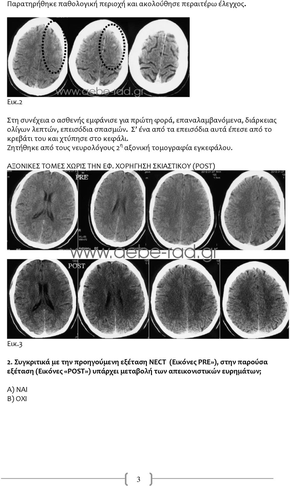 Σ ένα από τα επεισόδια αυτά έπεσε από το κρεβάτι του και χτύπησε στο κεφάλι.