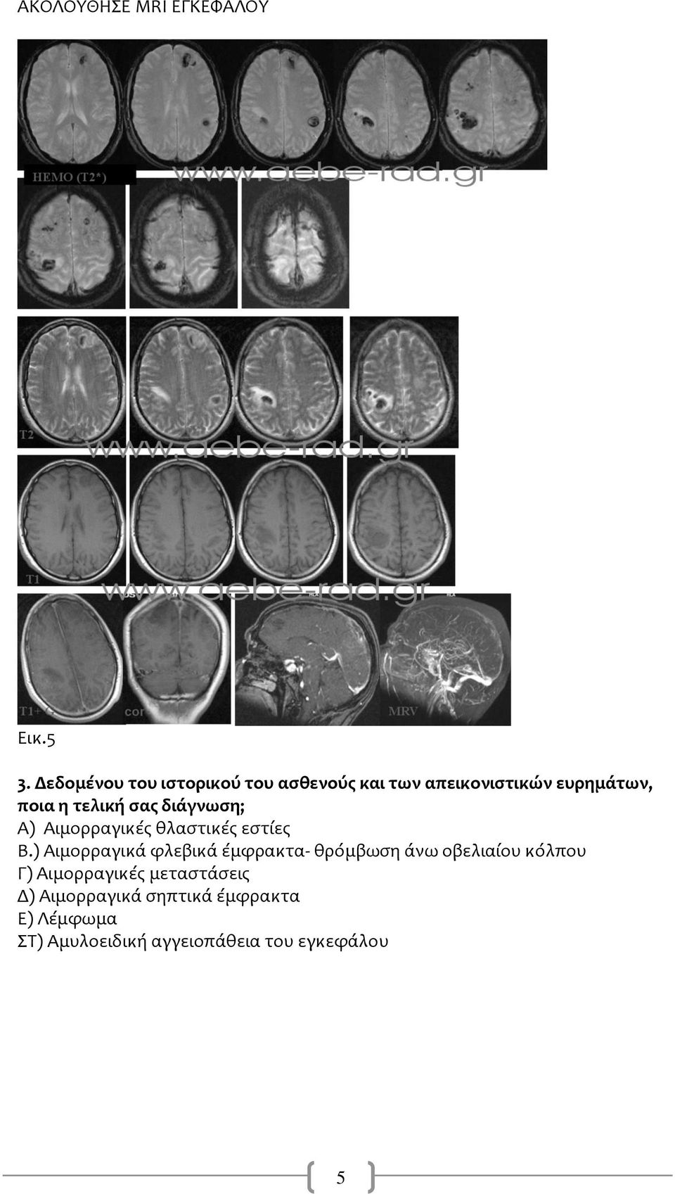 σας διάγνωση; Α) Αιμορραγικές θλαστικές εστίες Β.