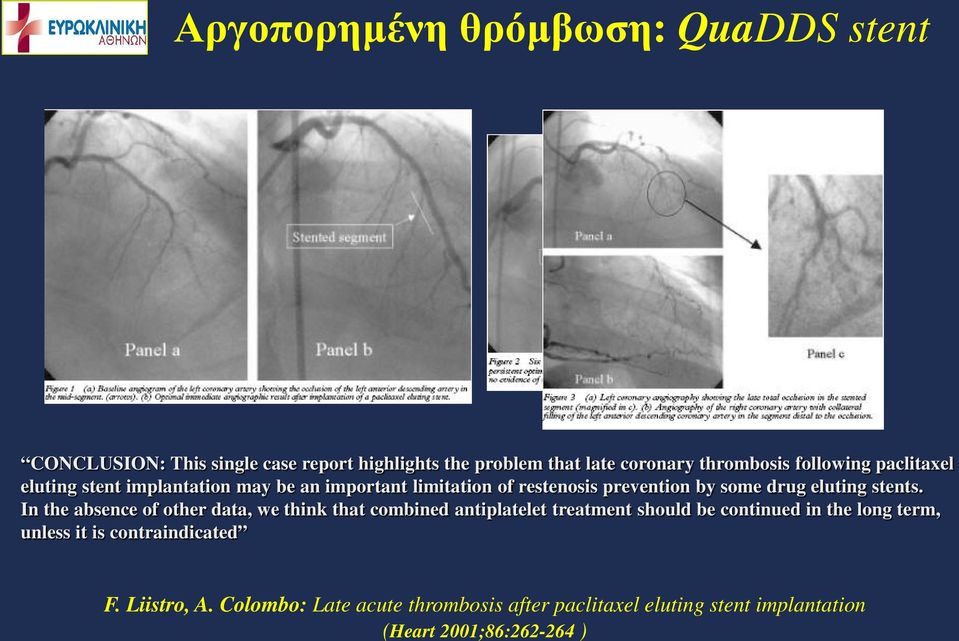 report highlights the problem that late coronary thrombosis following paclitaxel eluting stent implantation may be an important