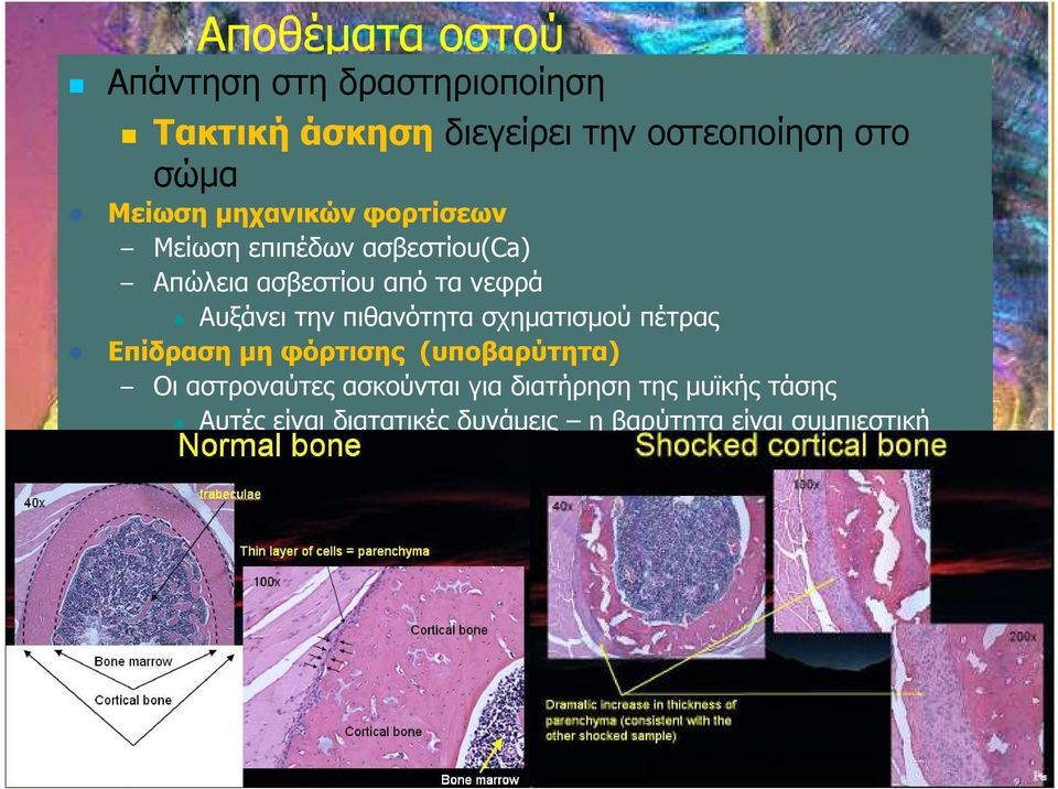 Αυξάνει την πιθανότητα σχηµατισµού πέτρας Επίδραση µη φόρτισης (υποβαρύτητα) Οι αστροναύτες