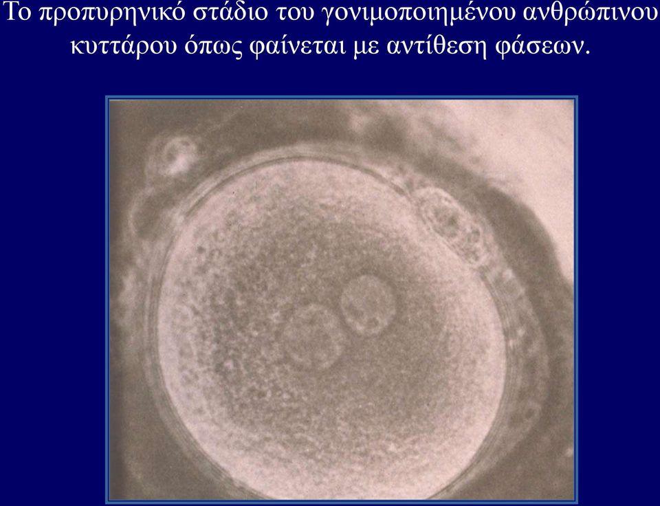 ανθρώπινου κυττάρου