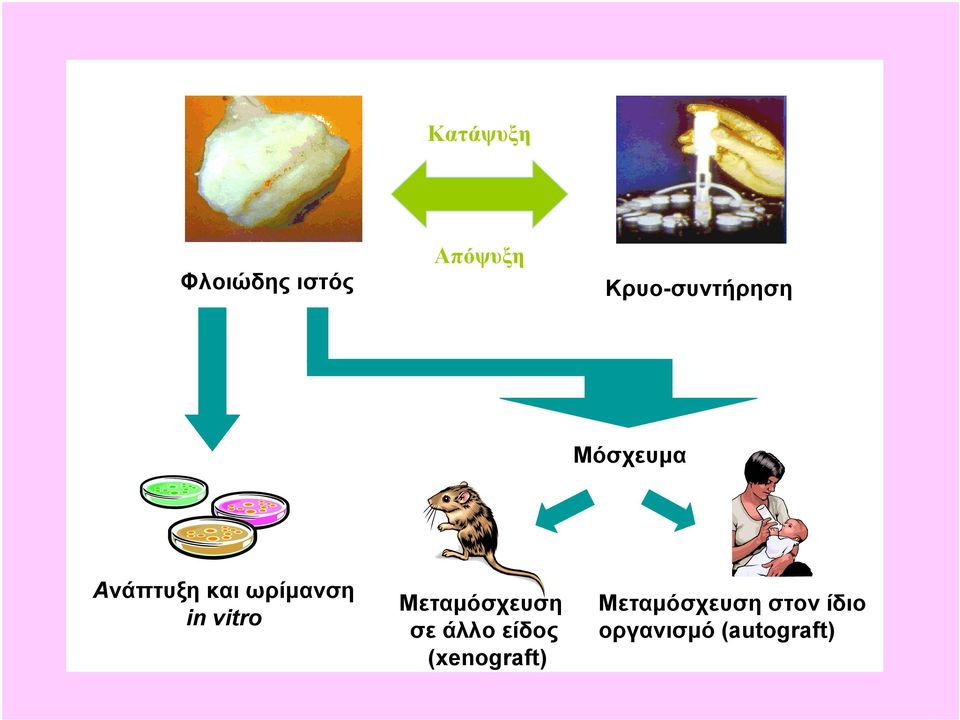 ωρίμανση in vitro Μεταμόσχευση σε άλλο